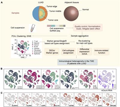 Single-Cell Analysis Reveals Spatial Heterogeneity of Immune Cells in Lung Adenocarcinoma